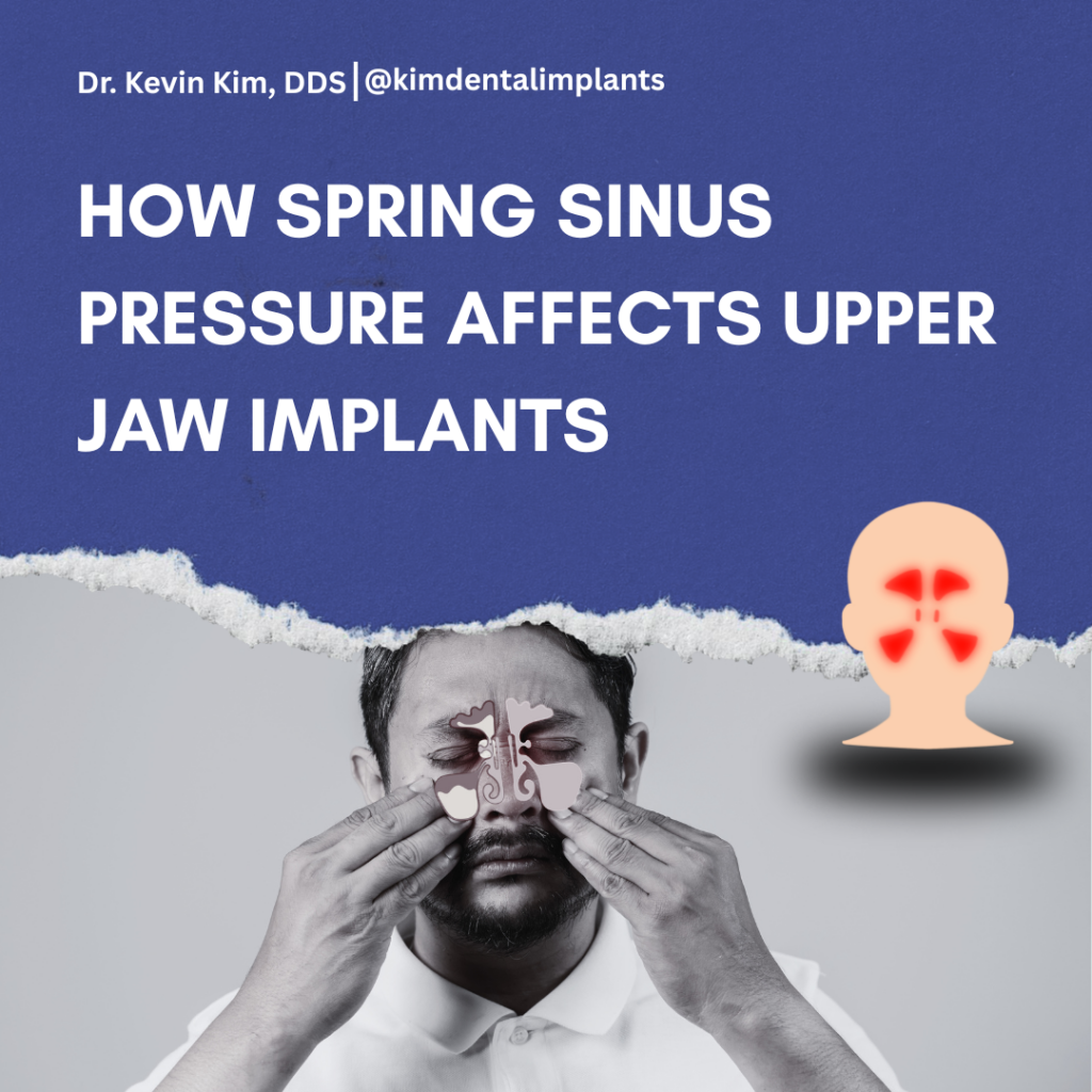 An infographic featuring a man holding his face in discomfort with an overlay of a sinus anatomy diagram. The text reads: "How Spring Sinus Pressure Affects Upper Jaw Implants" with Dr. Kevin Kim's branding.