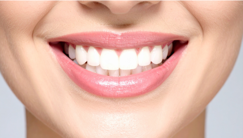 A close-up, smiling mouth showing healthy gums and perfectly restored, natural-looking teeth achieved through dental implant surgery.