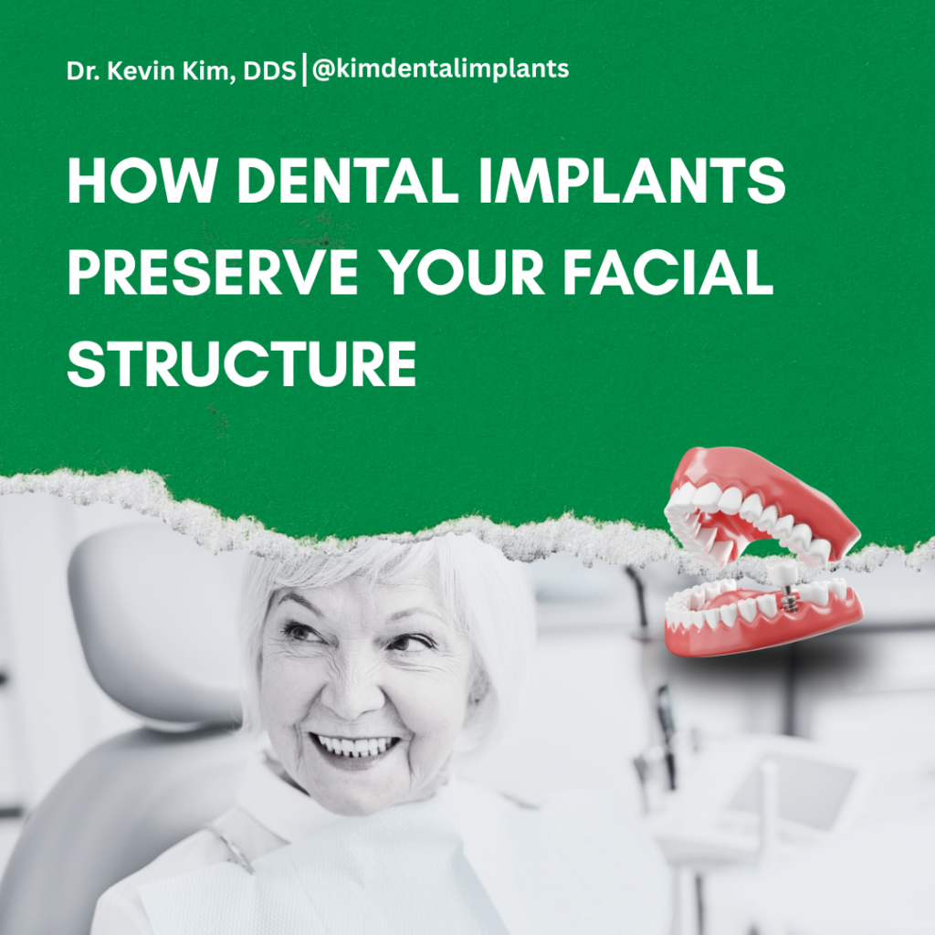 A side-by-side comparison diagram showing how a missing tooth causes jawbone loss and a sunken facial structure versus how a dental implant preserves a youthful jawline and facial fullness.