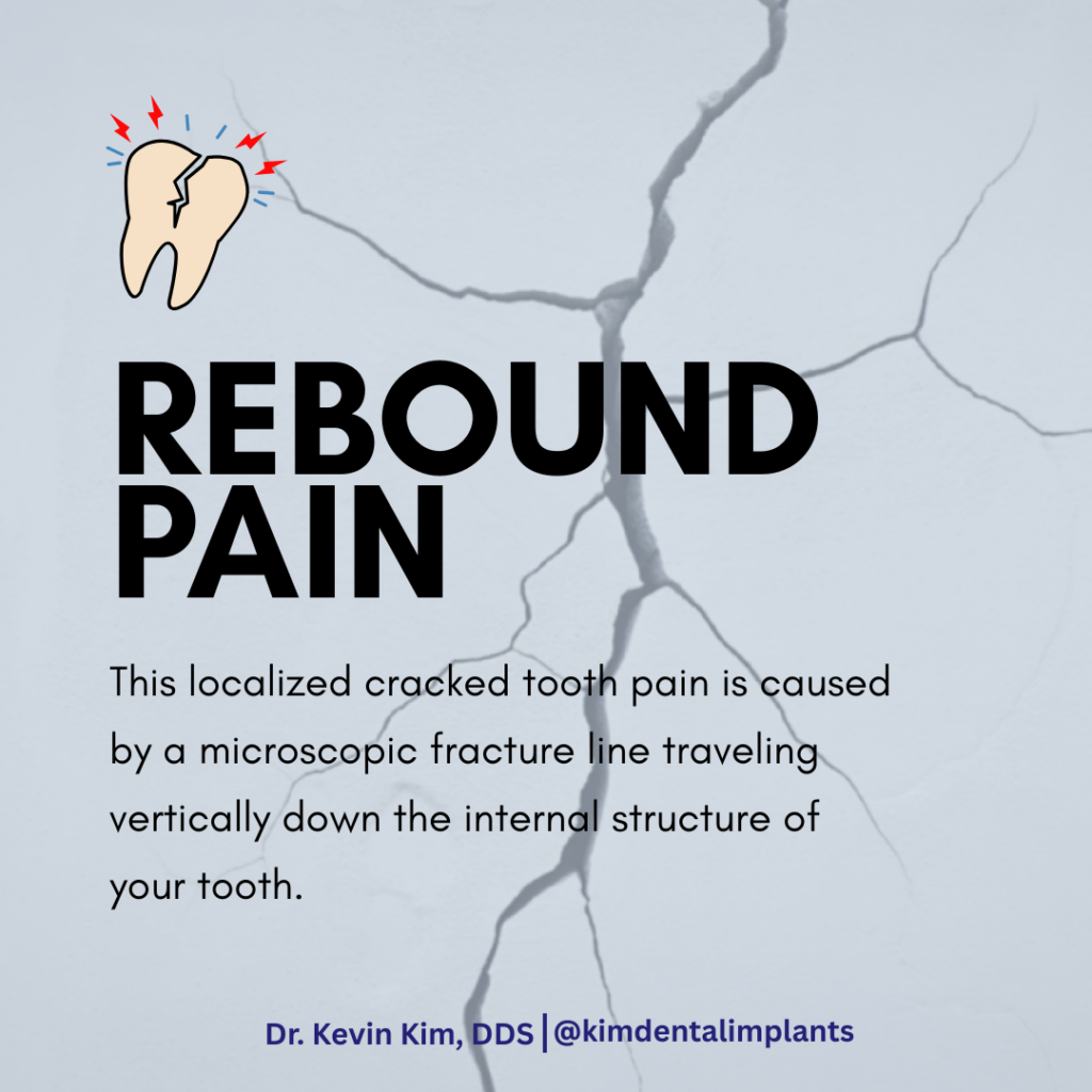rebound pain fix cracked teeth