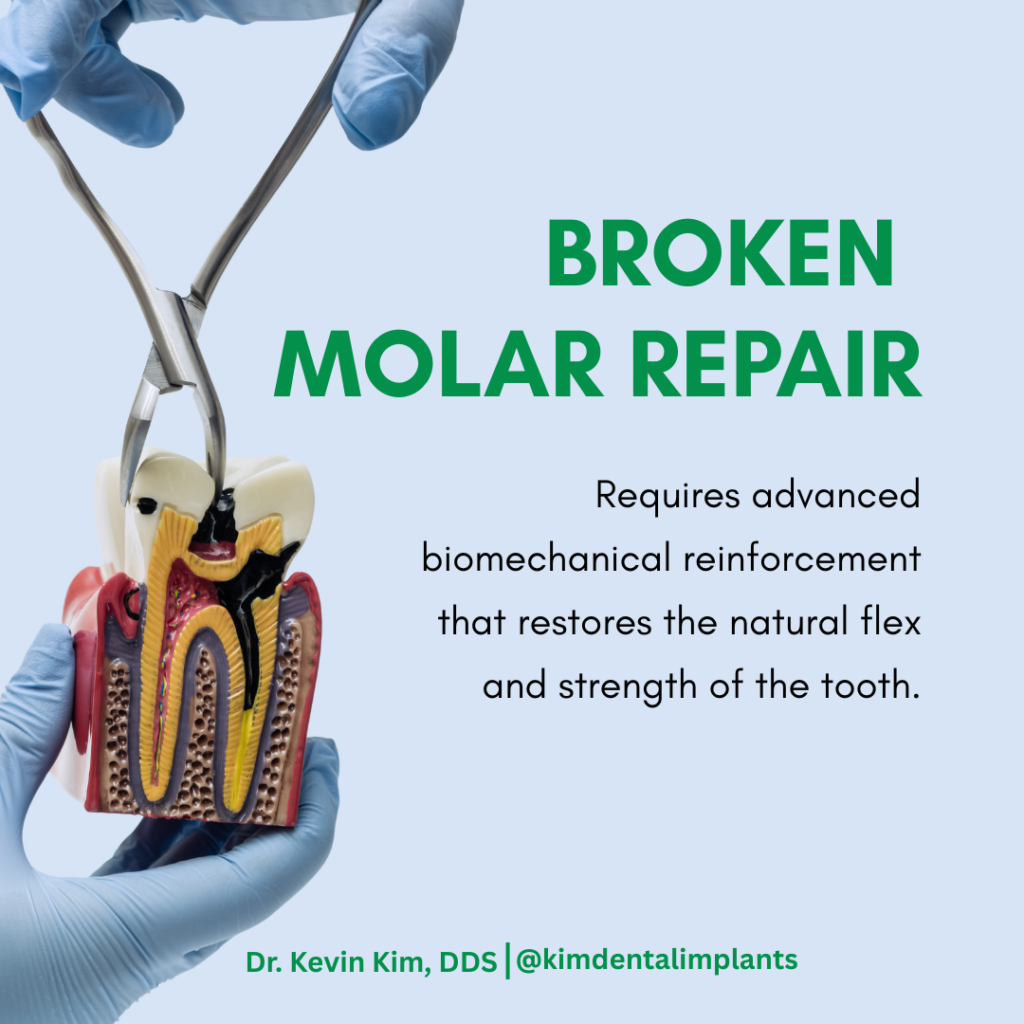 broken molars